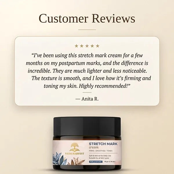 Natural Stretch Mark Cream for Women & Men – 50gm