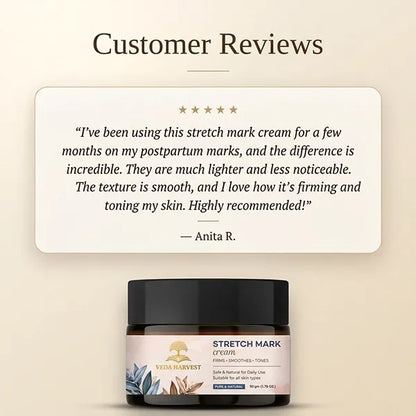 Natural Stretch Mark Cream for Women & Men – 50gm