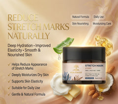 Natural Stretch Mark Cream for Women & Men - 50gm