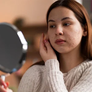 Reduces-dark-spots-and-pigmentation