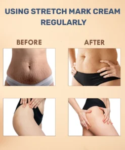 Natural Stretch Mark Cream