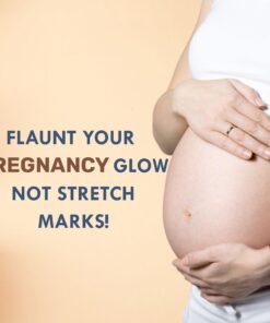 natural stretch mark cream