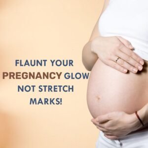 natural stretch mark cream